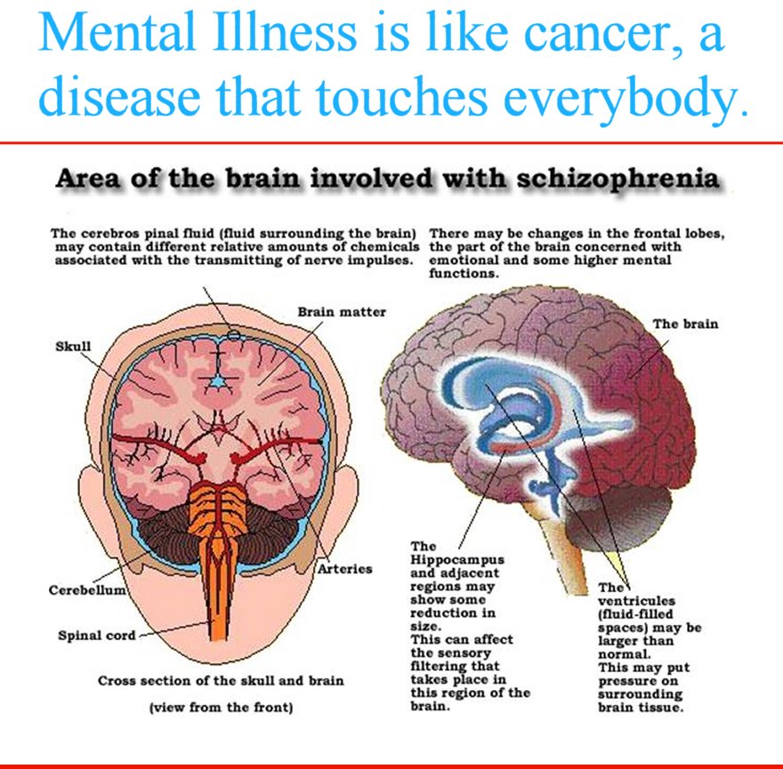 Mental Illness
